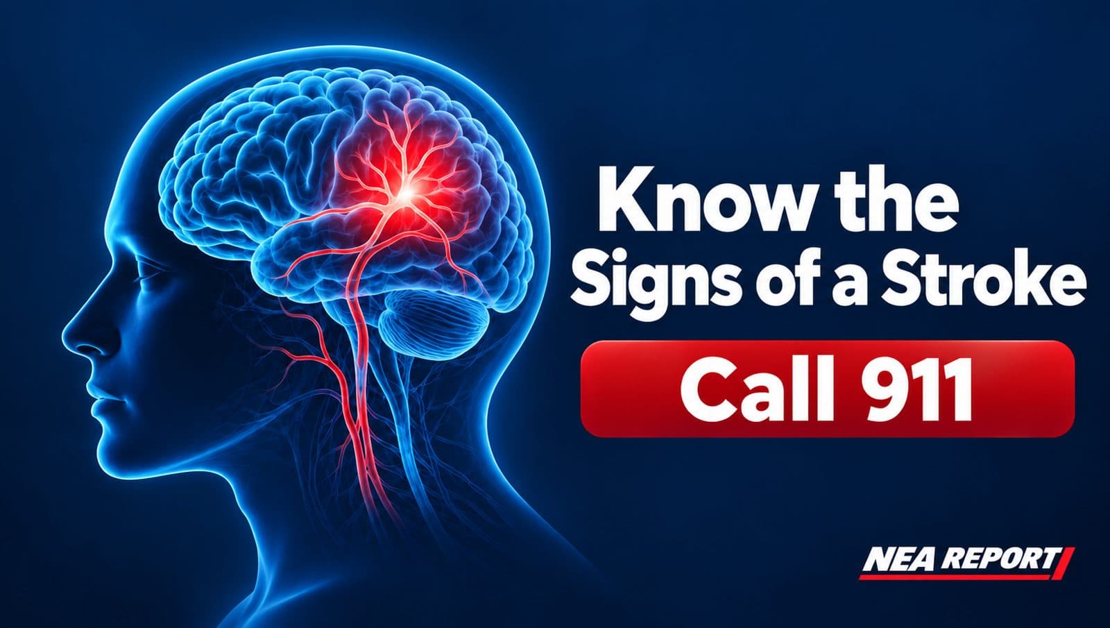 Arkansas Health Officials Stress Stroke Awareness Ahead of World Stroke Day