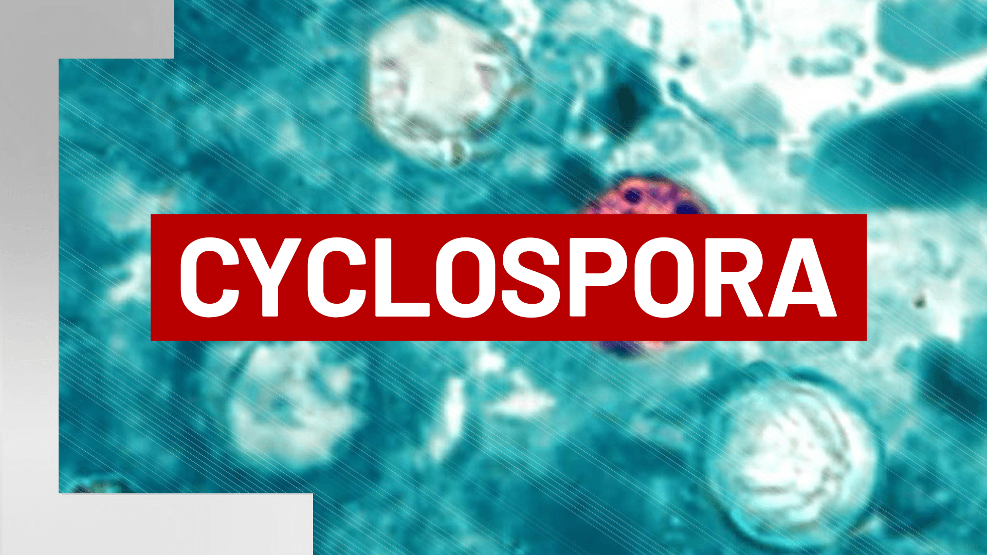 Cyclospora Cases Surge in Arkansas, Northeast Counties Also Affected