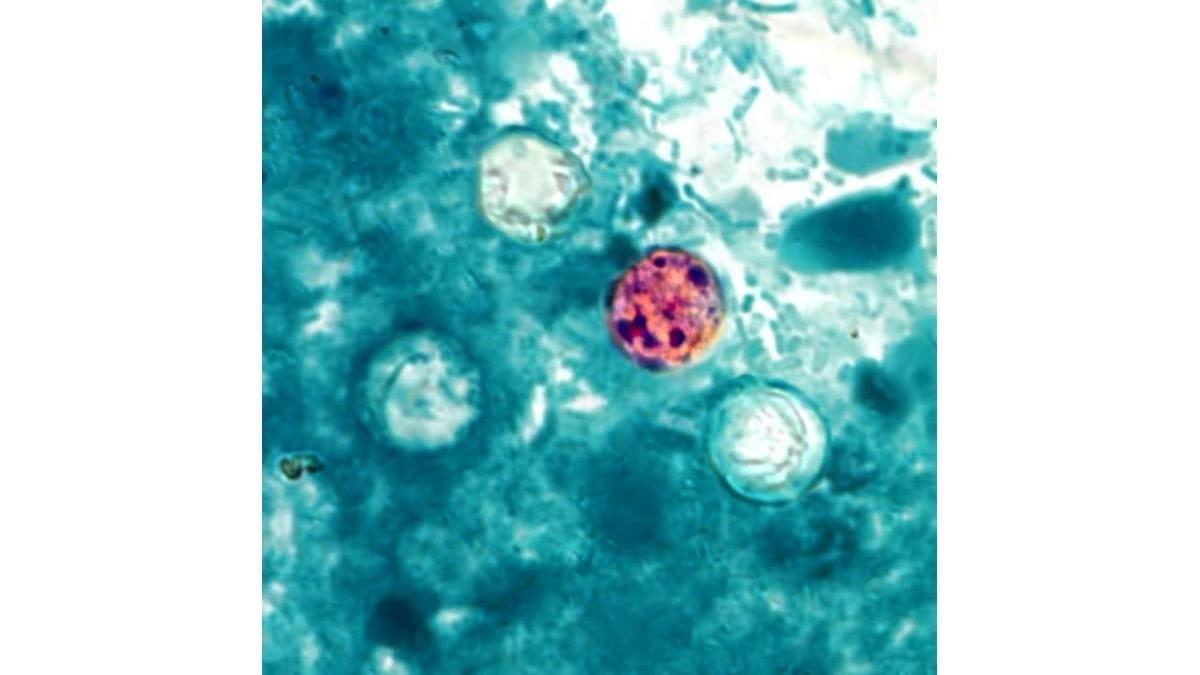 Cyclosporiasis Cases Confirmed in Baxter County, Statewide Numbers Rise